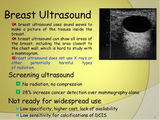 ultrasound to detect breast cancer White teens black guys